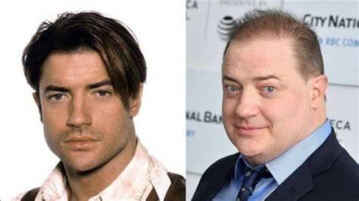 Brendan Fraser Weight Gain: What disease Does Brendan Fraser Have?