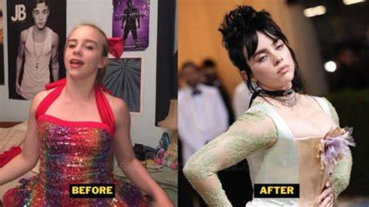 Did Billie Eilish Get a Boob Job?