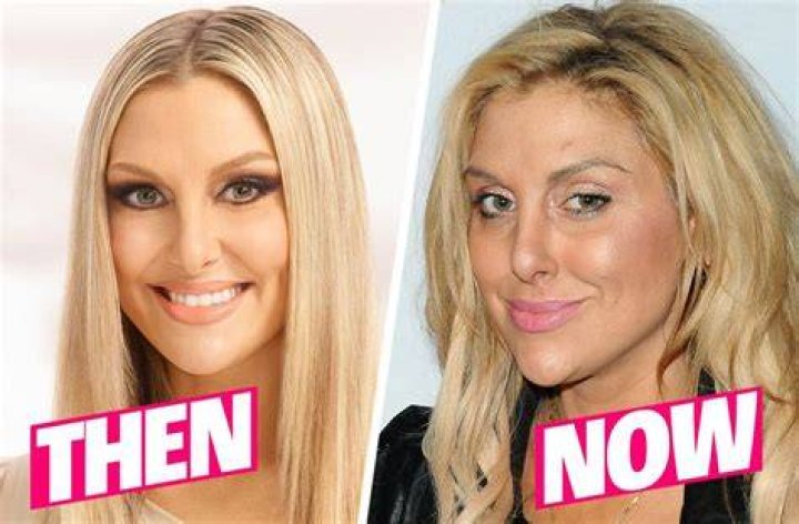 RHOC: Nicole Weiss Before Surgery – How Did She Look? Young Photos