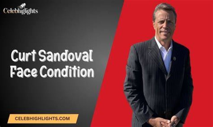What Is Wrong With Curt Sandoval Face? Details to know